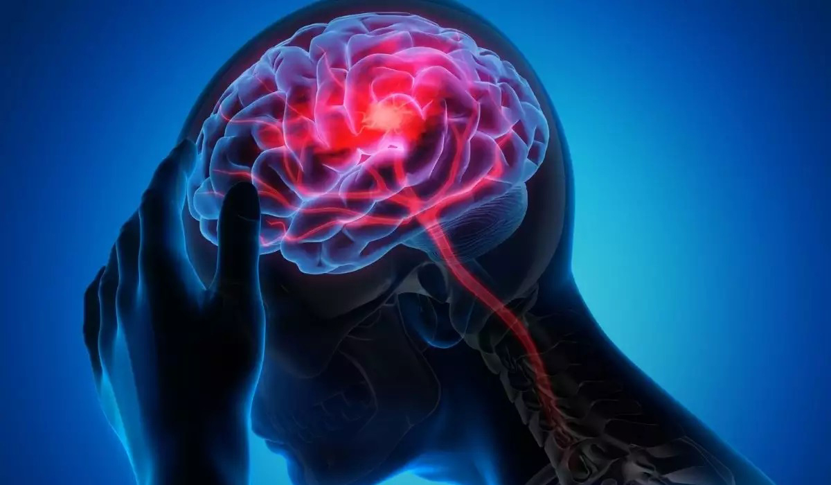 Covid-19 linked to higher risk of brain disorders up to two years on